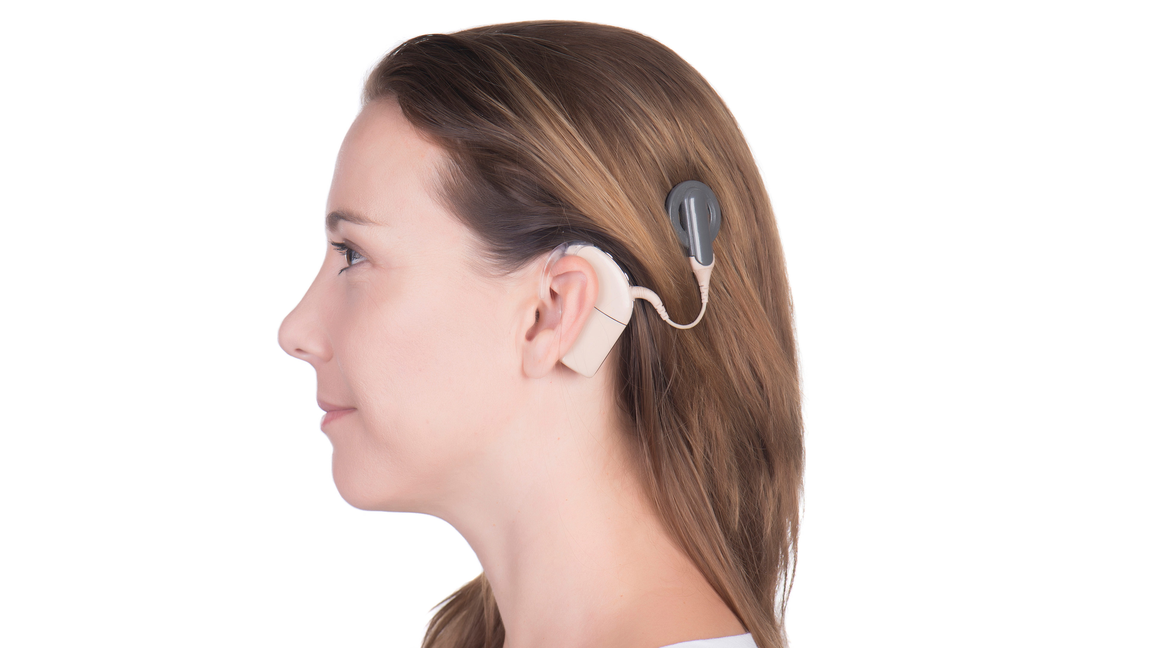 Cochlear Implant