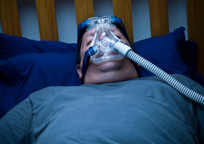 Sleep apnea